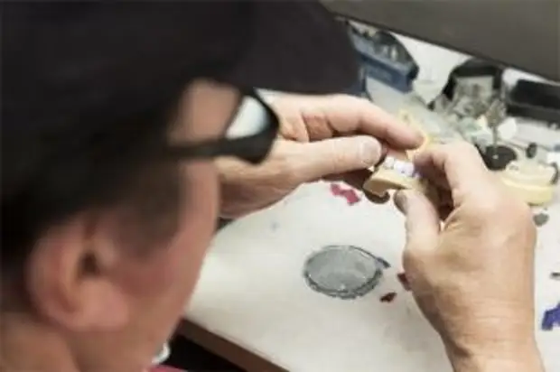 Что за новые зубные имплантаты создали в России?