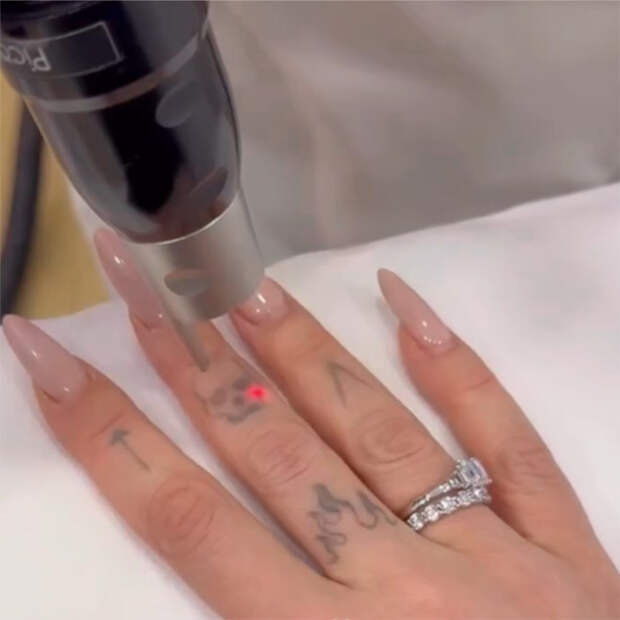 Анастасия Ивлеева начала удалять татуировки с тела