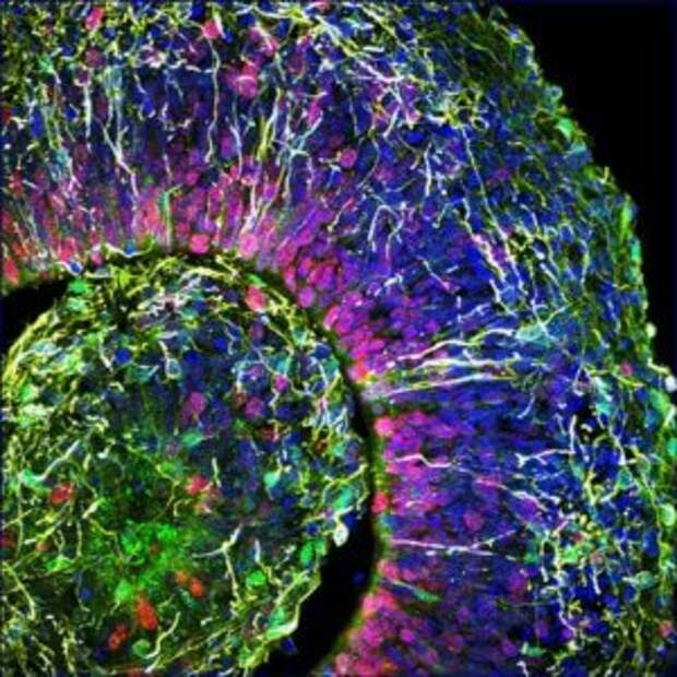 neuroscience cross section of a brain organoid