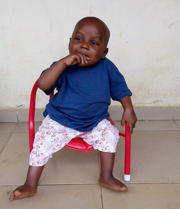 Как стал выглядеть спасенный мальчик, едва не умерший от недоедания  африка, дети, добро