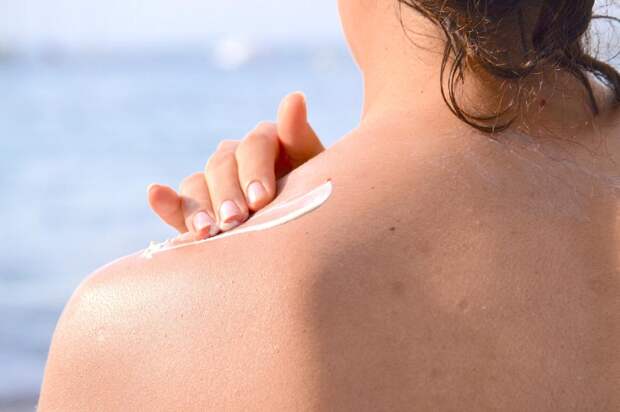 Пигмент или кровеносные сосуды: ученые объяснили, откуда берутся родимые пятна