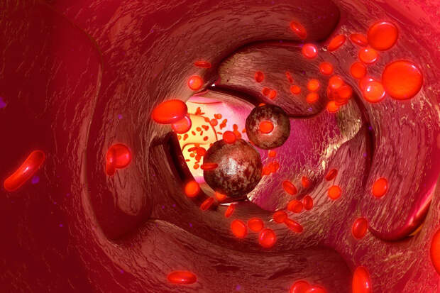 Ученые выяснили, как холестерин стимулирует рост агрессивного рака