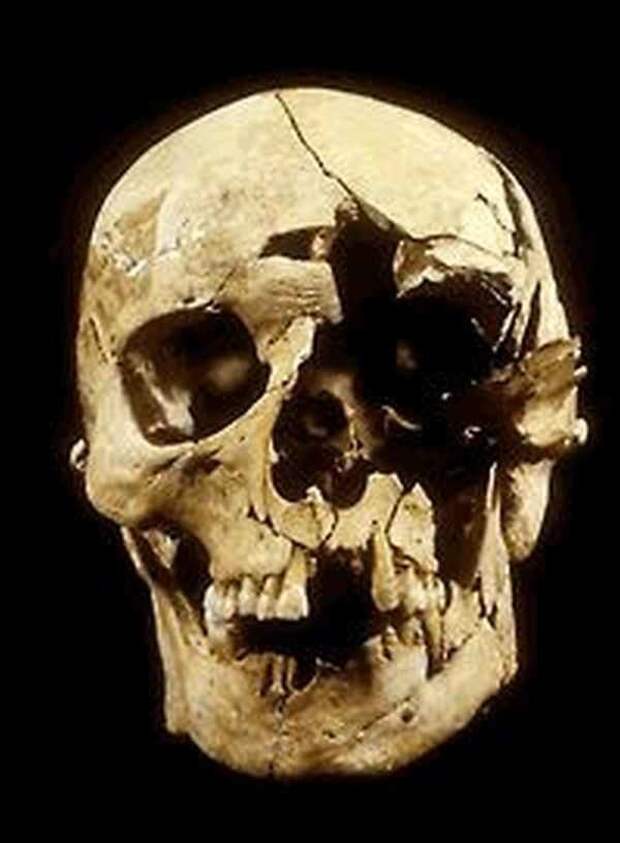 А вот этот череп сохранил для нас след удара боевым молотом. история, мумии, скелеты, тайна