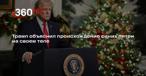 Трамп признался, что принимает большое количество аспирина для разжижения крови
