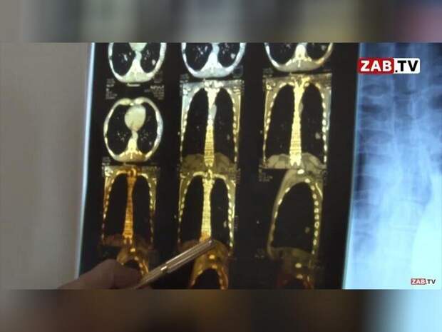 Минздрав представил демографический портрет онкопациента