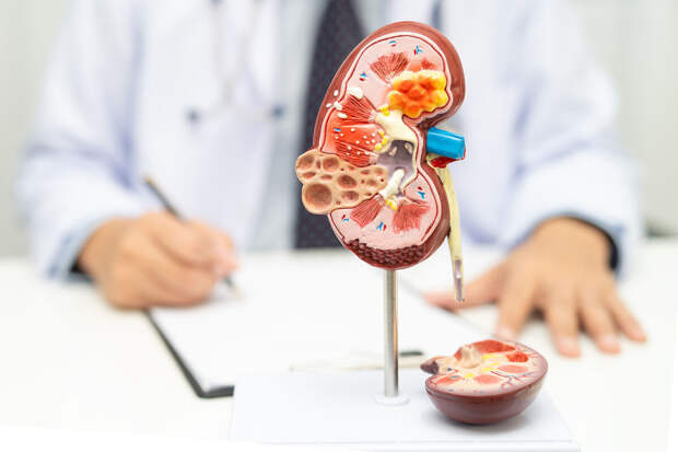 Нефролог Котенко: обезболивающие лекарственные средства вызывают ишемию почек