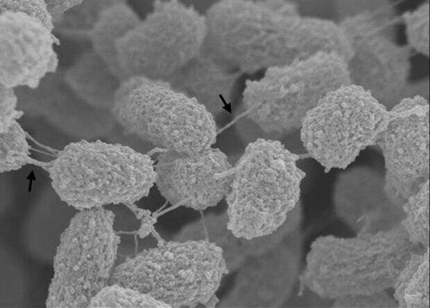 Попытка защититься от бактериофагов вернула бактерии чувствительность к антибиотикам