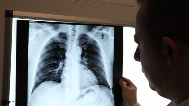 Опасность без симптомов: онколог рассказал о скрытых опухолях