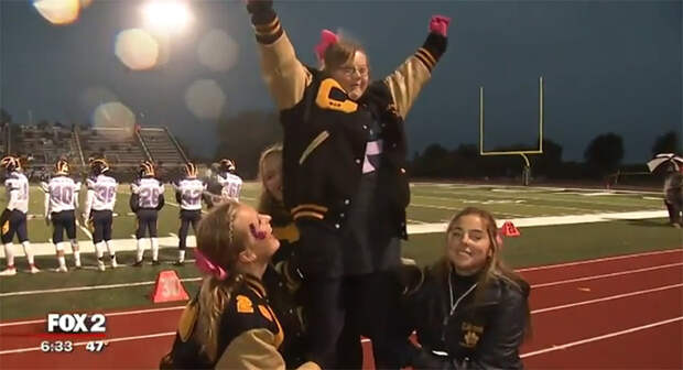 cheerleader down syndrome