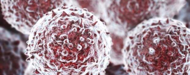 Что такое дистрофия? Виды, классификация, симптомы, лечение и причины