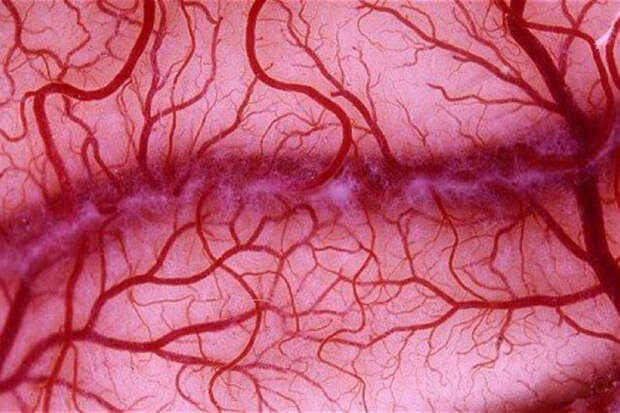 Angiogenesis: аневризма чаще поражает "слабые места" артерий