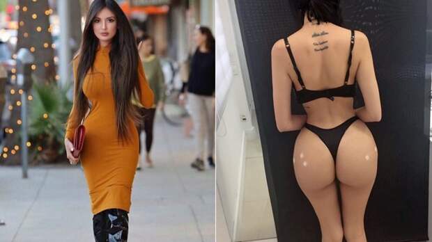 Поклонница Кардашьян потратила полмиллиона долларов на пластику, чтобы выглядеть как Ким задница, знаменитости. внешность, операция, тело, фигура