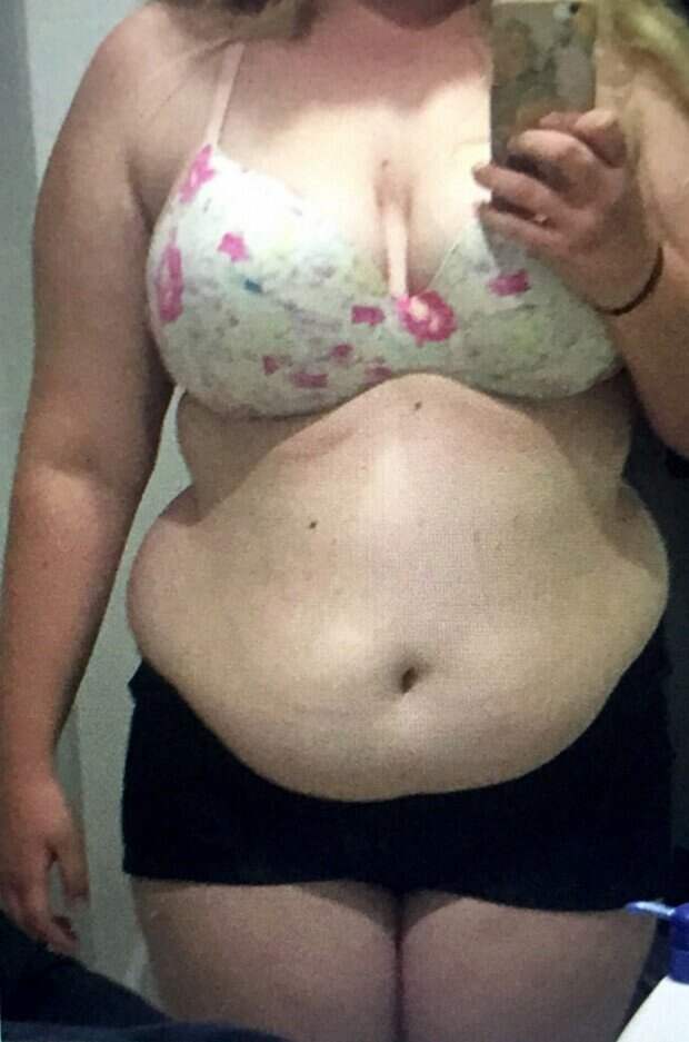 Девушка сбросила 63 кило, отказавшись от сахара Джозефина Десгранд, диеты, личный опыт, лишний вес, похудение, сбросить вес, сладкое, хочешь похудеть - спроси меня
