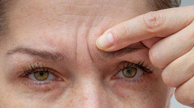 Почему появляются морщины и как замедлить этот процесс