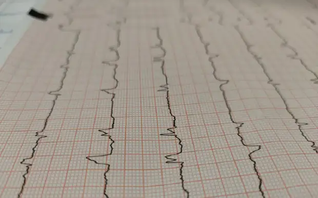 Новые холтеры в поликлинике ОКБ помогли в диагностике 112 человек