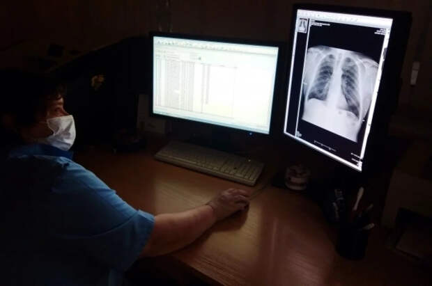 Онколог Черемушкин объяснил чудо исцеления американца от рака легкого