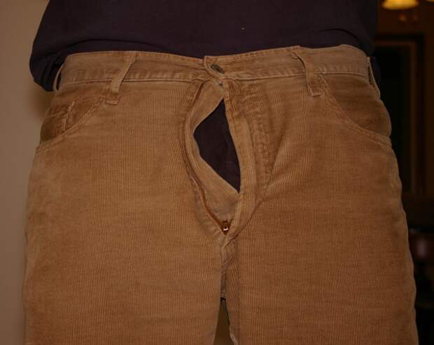 unzipped pants