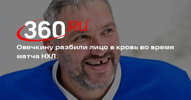 Овечкину разбили лицо в кровь во время матча НХЛ против «Чикаго»