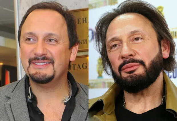 «Ему бы этого не делать»: как пластика изуродовала лицо 41-летнего Евгения Плющенко, но не помогла 62-летнему Звереву