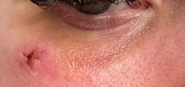 Девушка упала лицом на гвоздь во время хоррор-квеста в Волгограде