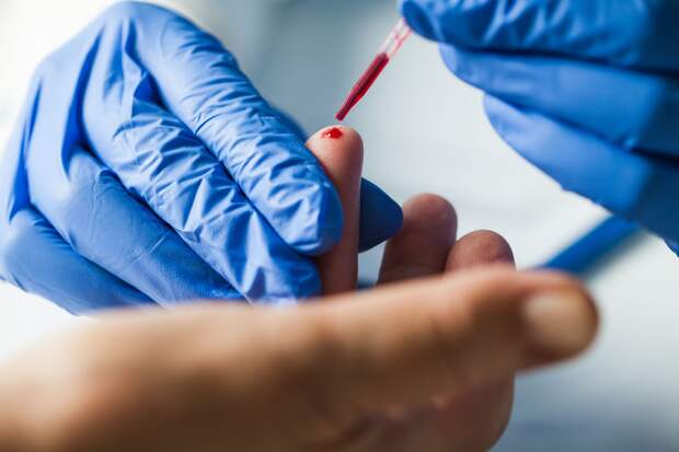 Одиннадцать мобильных пунктов тестирования на ВИЧ-инфекцию заработают в Удмуртии 30 ноября