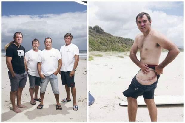 Четверо мужчин, каждый из которых подвергся нападению акул, создали свой Bite Club в котором оказывают всяческую помощь тем, кто пострадал от акульих атак акулы, бывает же такое, жизнь, нападения, травмы, факты