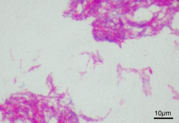 Туберкулезная палочка Mycobacterium bovis