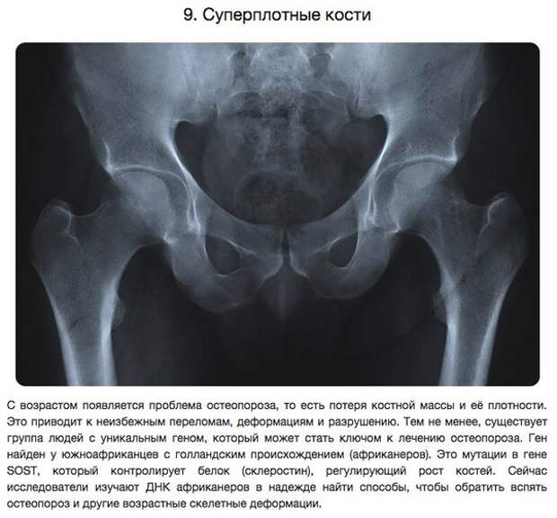 10 удивительных способностей, полученных в результате генетических мутаций 10 удивительных способностей, полученных в результате генетических мутаций