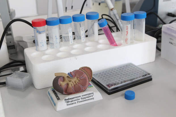 Ученые выявили новый фактор развития диабета - угрозу найдут по ладони