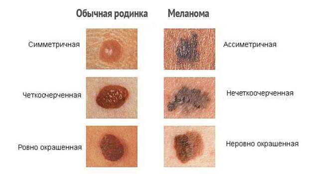 Самые опасные и незаметные болезни