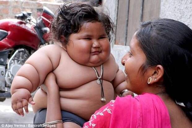 Индийская 8-месячная девочка страдает ожирением