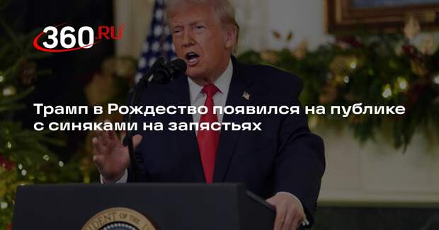 Трамп в Рождество появился на публике с синяками на запястьях