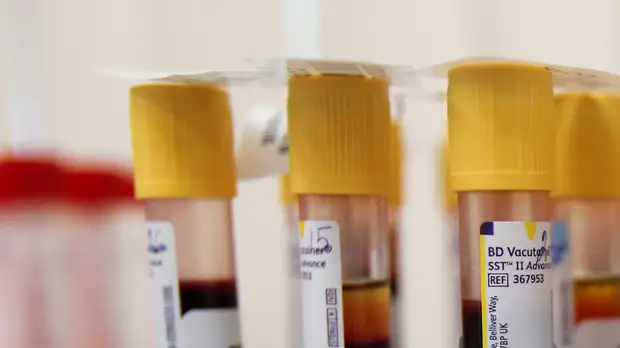 В Татарстане выявили 70 случаев COVID-19 за сутки