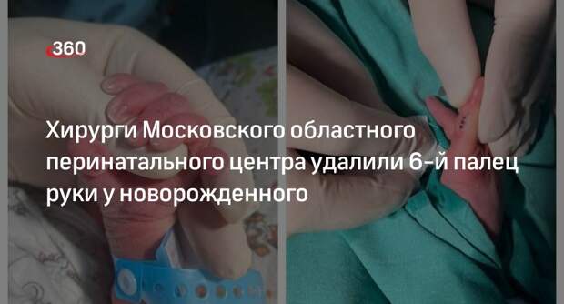 Хирурги Московского областного перинатального центра удалили 6-й палец руки у новорожденного