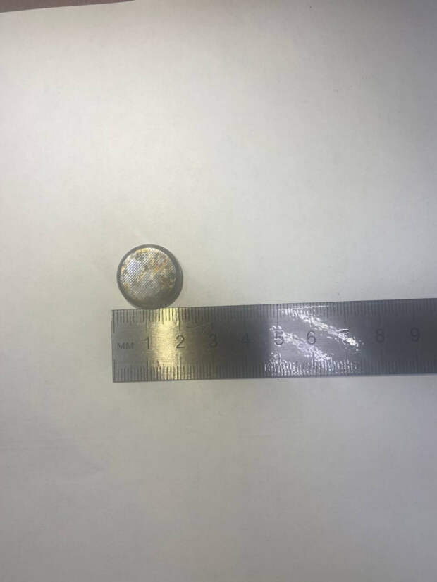 В Новороссийске ребенок проглотил батарейку: потребовалась операция