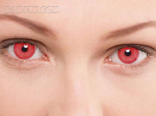 Красный цвет: глаза альбиноса
