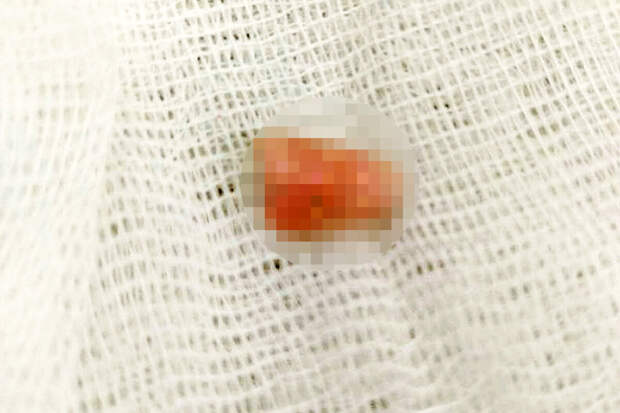 В Челябинской области младенец чуть не задохнулся из-за маникюра матери