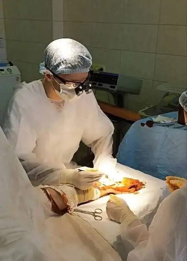 В Симферопольской клинической больнице СМП №6 начали проводить операции по реплантации пальцев и кистей рук