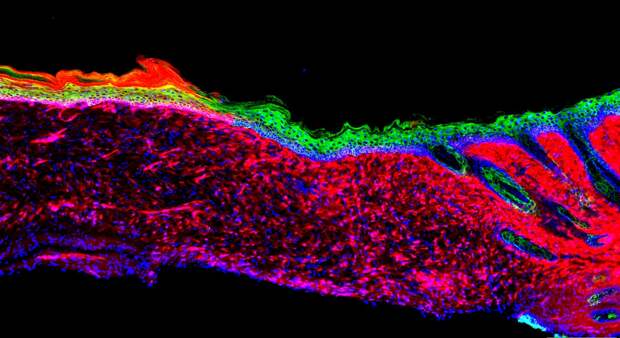 cross-section of regenerated skin with different cell types