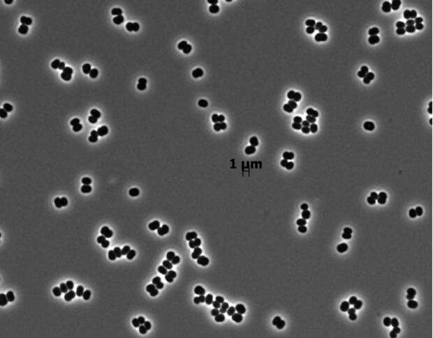 Микробы Tersicoccus phoenicis были обнаружены там, где вообще не должно быть никакой жизни, в стерильных помещениях NASA