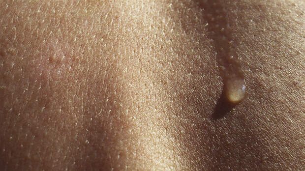 Врач объяснил, о каких болезнях может сигнализировать повышенная потливость