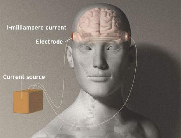 Стимуляция мозга tDCS