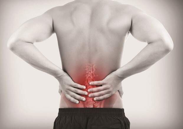 Картинки по запросу Межпозвонковые грыжи влияют на боль в спине