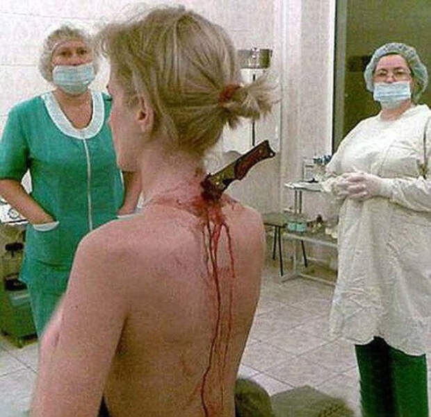Стальная спина 22-летняя Юлия Попова возвращалась с работы, когда на нее напал маньяк. По счастью, рядом проходил полицейский патруль и убийцу спугнули. Каков же был ужас прибывших на место врачей, которые обнаружили торчащий из спины Юлии нож! По счастью, хирурги сумели вытащить страшное оружие, не повредив внутренним органам девушки.