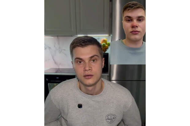 Муж попал на операционный стол после выдавленного женой прыща