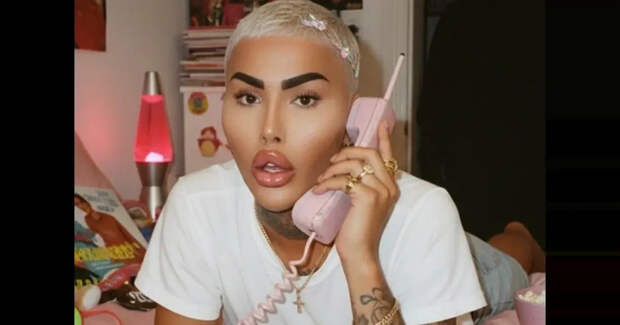 "Король губ" Джордан Парк умер в 34 года после очередной бьюти-процедуры