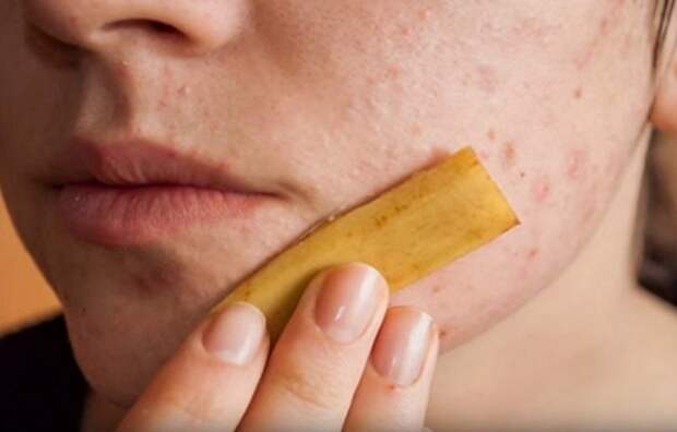 take-a-banana-peel-rub-it-on-your-face-and-get-amazed-at-what-happens-to-your-skin