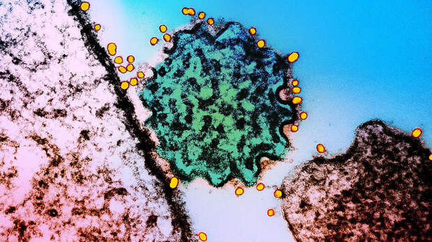 Врач Панфилова: вспышки вируса Нипах в Индии удаётся быстро локализовать