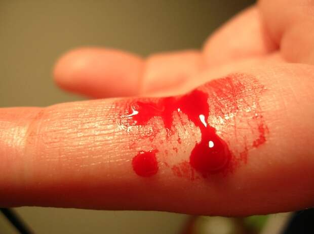 кровь из пальца