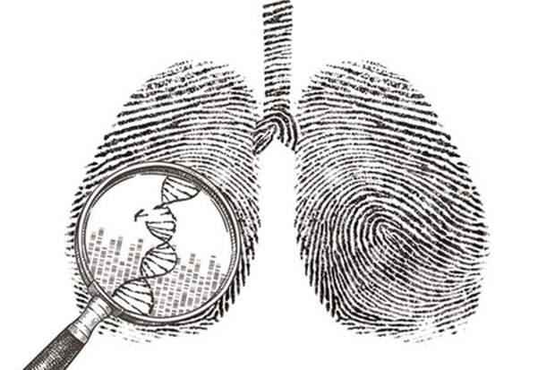 IJMS: гормон роста активирует белки, выкачивающие лекарства из клеток рака